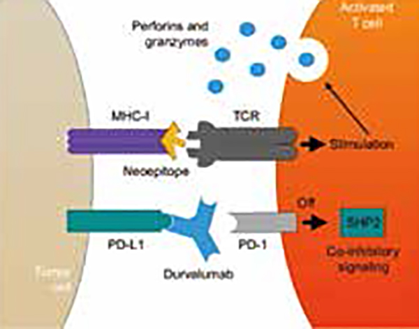 食管癌Durvalumab辅助免疫治疗小样本研究