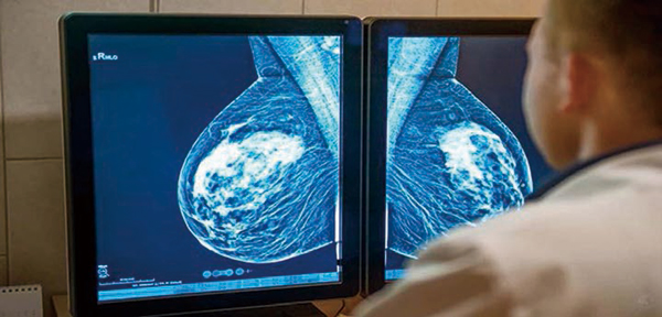 快速乳房磁共振成像后乳腺密集和平均风险较高的女性仍需辅助检查
