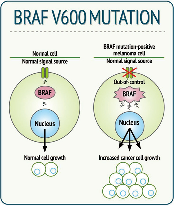 BRAF V600突变晚期黑色素瘤 一线抗PD-1单药优于BRAF/MEK抑制剂