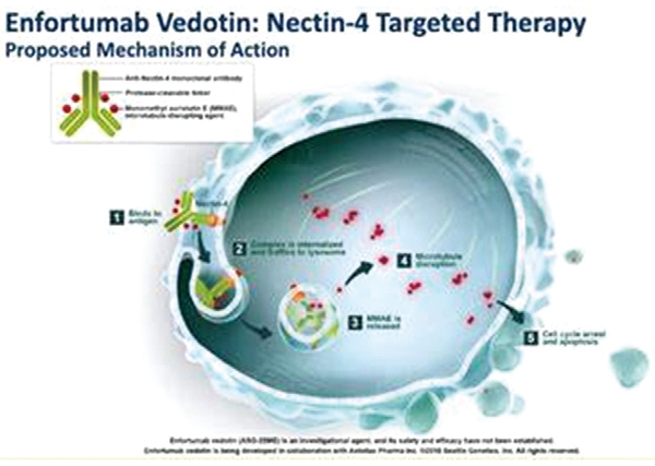 转移性尿路上皮癌 Enfortumab vedotin或优于标准化疗