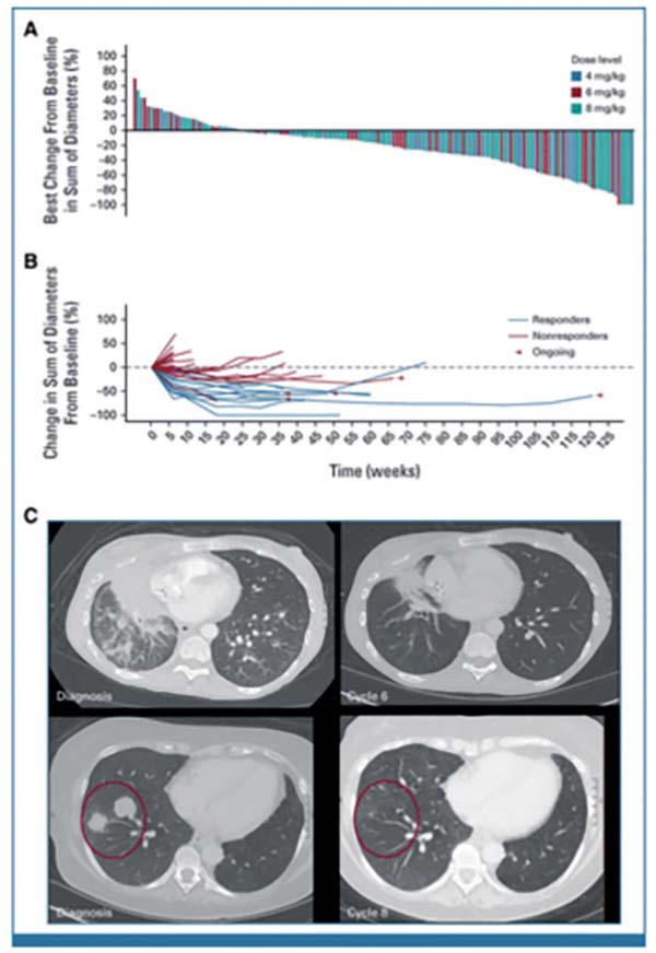 多线治疗失败的晚期NSCLC Dato-DXd有抗瘤活性且安全性可控