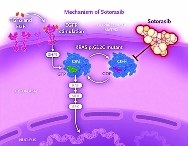 KRAS G12C突变的难治性结直肠癌 Sotorasib联合帕尼单抗延长无进展生存期