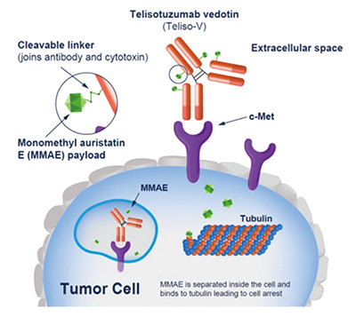 c-Met过表达、EGFR突变、晚期NSCLC 奥希替尼失败后联用Teliso-V或安全有效