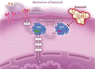 KRAS G12C突变的、非鳞状NSCLC sotorasib联合卡铂-培美曲塞疗效好