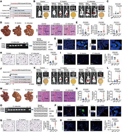 研究发现新型肠菌直接促进肝癌发生