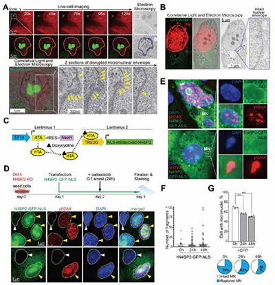 389-390期《全球肿瘤快讯》-92-.jpg 389-390期《全球肿瘤快讯》-92-.jpg