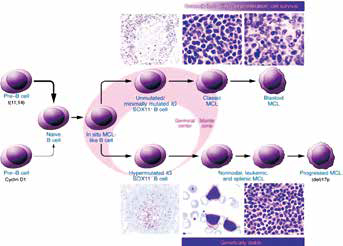 389-390期《全球肿瘤快讯》-153.jpg 389-390期《全球肿瘤快讯》-153.jpg