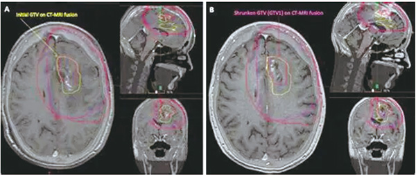391-392期(完成)-83-.jpg 391-392期(完成)-83-.jpg