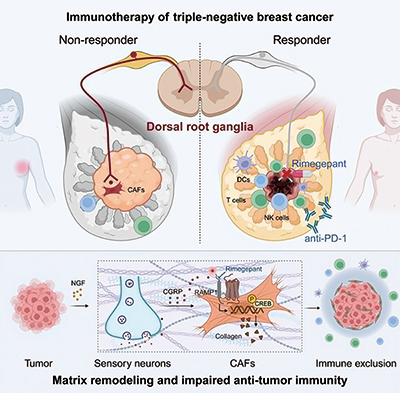 三阴性乳腺癌  肿瘤分泌神经生长因子诱导微环境“物理抗癌”
