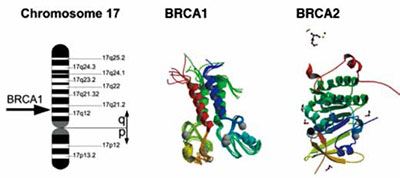 BRCA突变不影响年轻乳腺癌患者生存