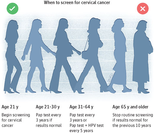 宫颈癌筛查终止年龄应推后