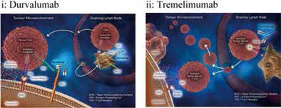 Tremelimumab联合Durvalumab治疗恶性间皮瘤值得研究