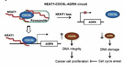 国人研究发现前列腺癌生长机制关键非编码RNA