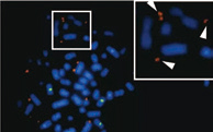 Cell：胶质母细胞瘤ecDNA研究