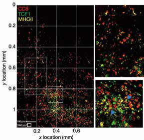 免疫效果差是干细胞样CD8+T细胞减少所致？