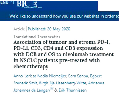 NSCLC 免疫细胞间质浸润可预测PD-1抑制剂疗效