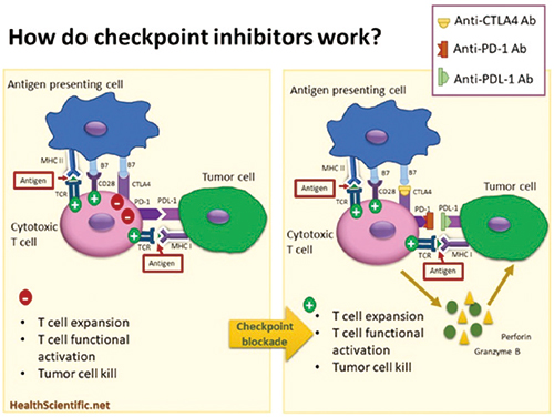 NSCLC 合并ILD者仍可用免疫检查点抑制剂