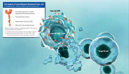 早期复发或难治性大B细胞淋巴瘤 二线应用Lisocabtagene maraleucel改善EFS
