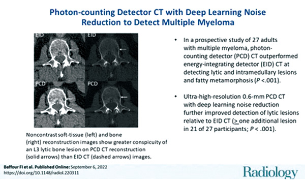 骨髓瘤相关骨病 光子计数探测器CT检出率更高