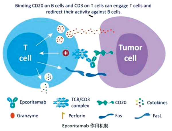 高度难治性大B细胞淋巴瘤 Epcoritamab有效且安全