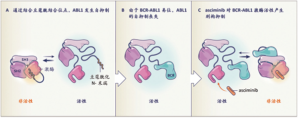 ASCEMBL长期随访显示 Asciminib或为优于Bosutinib的标准后线选择