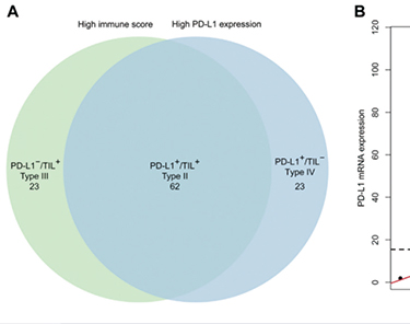 国人研究发现TIME综合分型可预测免疫治疗疗效