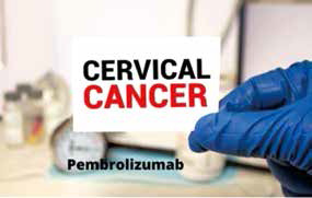 持续性、复发性或转移性宫颈癌 帕博利珠单抗加入联合或不联合贝伐珠单抗的化疗改善OS