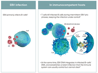 EBV阳性移植后淋巴细胞增生性疾病 Tabelecleucel或为一种可及的、变革性的选择