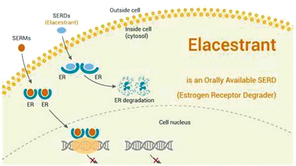 ER+、HER2-晚期或转移性乳腺癌 FDA批准Elacestrant治疗ESR1突变患者