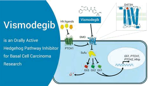 头颈部局部晚期基底细胞癌 Vismodegib联合放疗1年局部控制率达91%