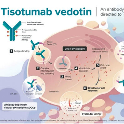 EGFR野生型非鳞状NSCLC c-Met过表达者后线应用Teliso-V有持久缓解