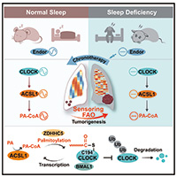 睡眠不足加速肿瘤生长？