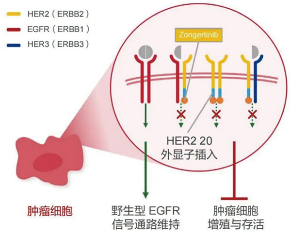 Zongertinib治疗HER2阳性NSCLC研究公布