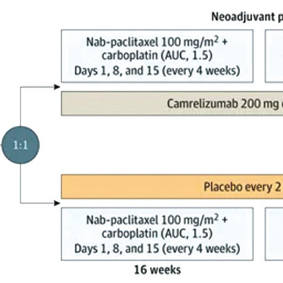 JAMA：复旦肿瘤“最毒乳腺癌”中国方案研究