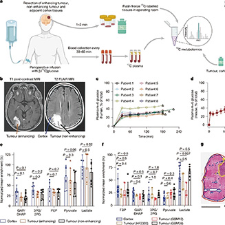 限制饮食丝氨酸抑制肿瘤增殖