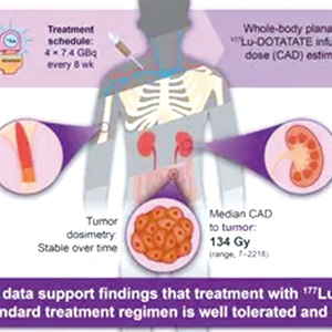进行性转移性嗜铬细胞瘤/副神经节瘤 177Lu-DOTATATE治疗有效且安全