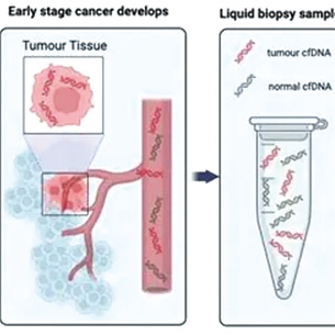 多癌种血检因证据不足尚待验证