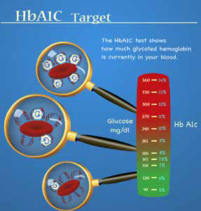 国人研究发现控制血糖可降低胰腺癌风险