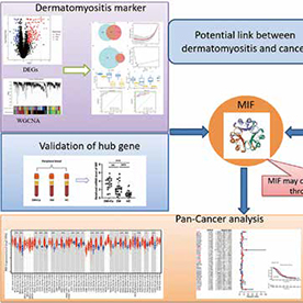 5指标TIP-CA模型可预测皮肌炎的患者患癌风险