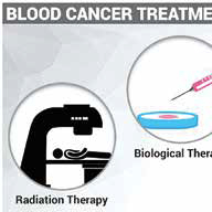一线治疗CLL 大多数患者应考虑疗程有限的方案