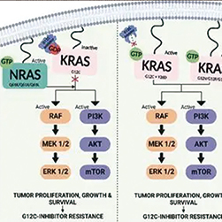 局部晚期、非鳞状NSCLC KRAS突变致远处转移和脑转移增多继而预后更差