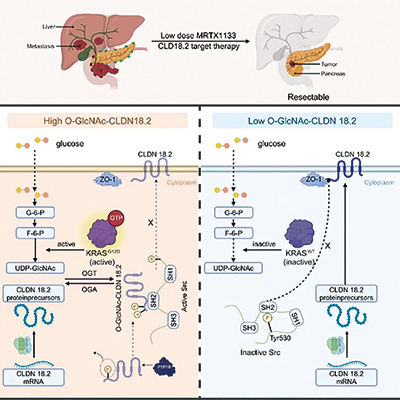 研究揭示CLDN18.2靶向治疗耐药机制