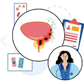 新的死亡风险预测模型可改善PSA结果解释性