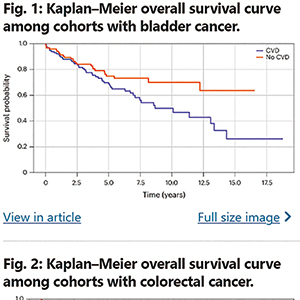 色觉障碍者或因不易发现血尿而延迟膀胱癌确诊