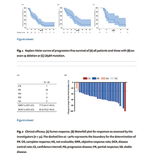 合并MPE的EGFR突变NSCLC 雷莫西尤单抗联合厄洛替尼一线治疗或有潜在价值